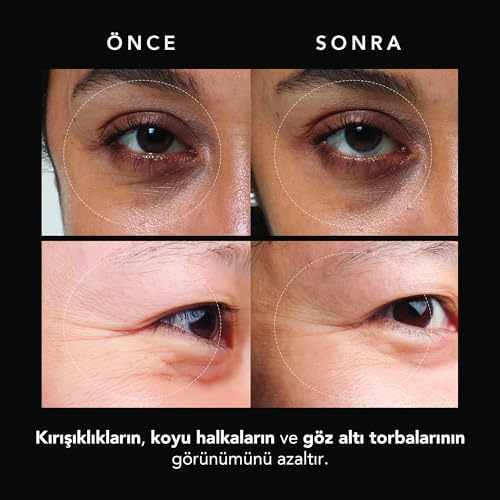 FAQ Mikroiğneli Kırışıklık Karşıtı Hyaluronik Asit Göz Altı Pedleri – Göz Altı Şişlikleri ve Morluklara Karşı Pedler – Anında Etki – Seyahat Dostu – 3x2 Adet