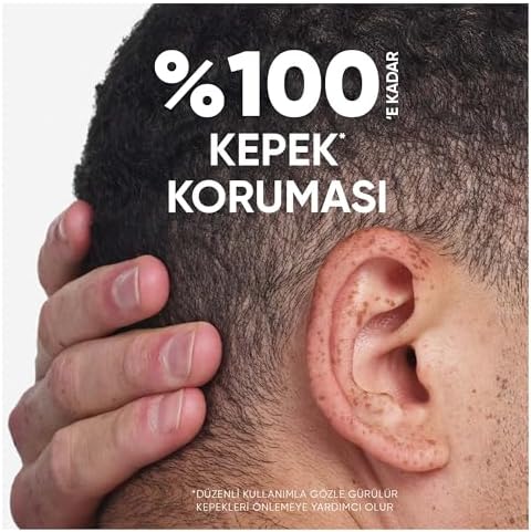 Head & Shoulders Klasik Bakım 2'si 1 Arada Kepeğe Karşı Etkili Şampuan 300ml