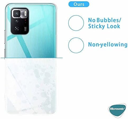 X3 GT için Kılıf Transparent Soft Beyaz [ X3 GT ile Uyumlu Kılıf - Şeffaf]