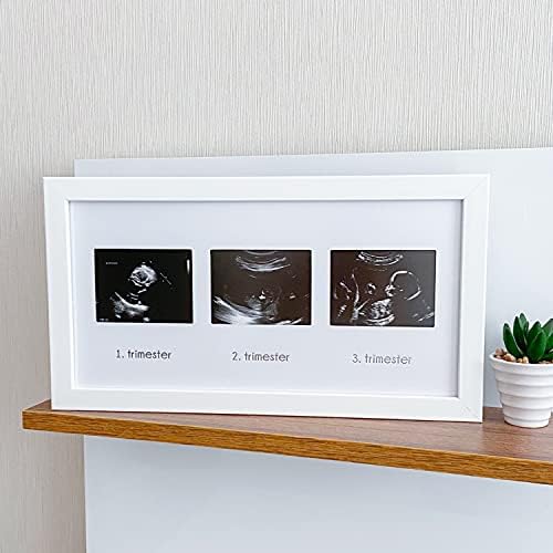 Üçlü Ultrason Anı Çerçevesi - Gebelikte Bebeğin Gelişimini Üç Trimester Anı Olarak Saklayın